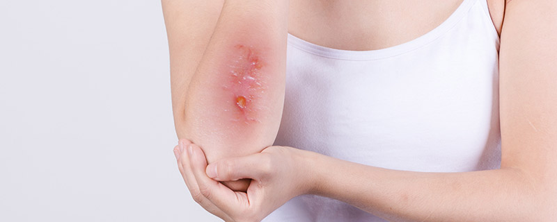 出门受伤出血什么预兆 出门受伤出血预示着什么