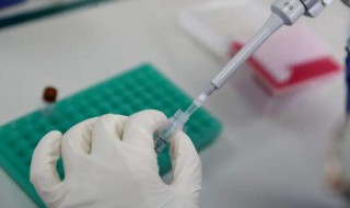 核酸检测前后注意什么 核酸检测前注意啥