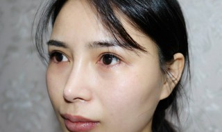 眼袋怎么去掉 眼袋怎么消除好