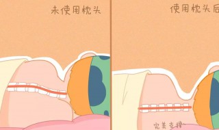 枕头正确枕法 圆形颈椎枕头正确枕法