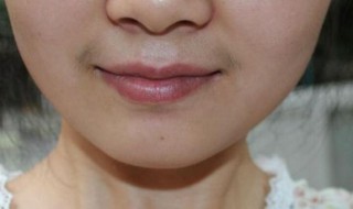 女生如何淡化唇毛（什么方法可以淡化唇毛）