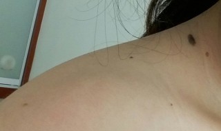 锁骨上有痣代表什么 女生右锁骨上有痣代表什么