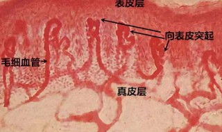 如何消除红血丝 如何消除红血丝面部