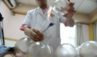 拔罐出水泡怎么回事 后背拔罐出水珠怎么回事