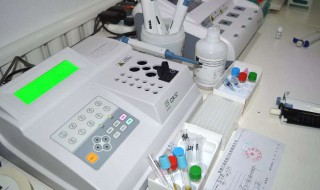 bod是什么意思 bod5是什么意思