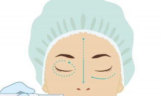 怎样能除去眼袋 怎样能除去眼袋上的皱纹
