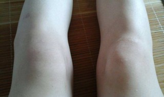 让膝盖变瘦的方法 让膝盖变瘦的方法有哪些