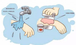 烫伤的处理方法 烫伤之后怎么办