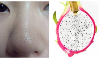 怎样消除黑头（怎样去除黑头粉刺毛孔粗大）