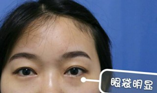 有什么祛眼袋的好方法（有什么祛眼袋的好方法吗）