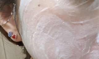 怎样去掉脸上的青春痘（怎样去掉脸上的青春痘痘）