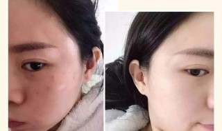 天生的黑皮肤如何变白（天生的黑皮肤如何变白学生）