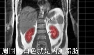 怎么知道是不是内脏脂肪多 怎么看是不是内脏脂肪