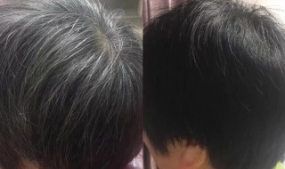 天然染黑发的方法（天然染黑发的方法中药）