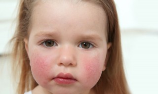 怎样才可以养好皮肤不黑（怎样才可以养好皮肤不黑的植物）